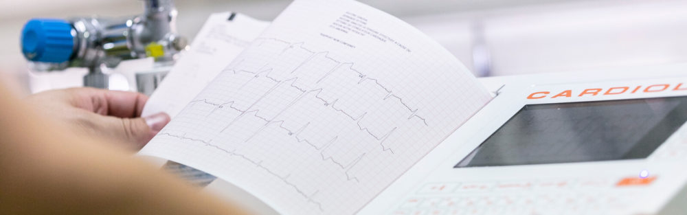 Une personne tient un rapport ECG imprimé à proximité d’un moniteur de cardiologie qui affiche des mesures cardiaques similaires.