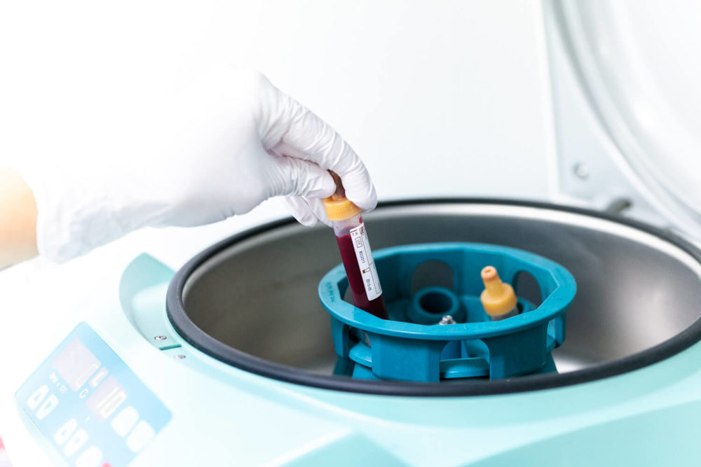 Une main portant un gant met un flacon de sang dans une centrifugeuse dans un laboratoire médical.