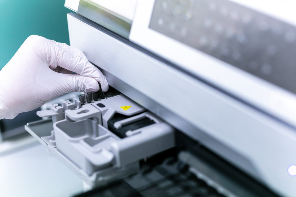 Une personne portant des gants blancs ajuste un échantillon dans un analyseur de laboratoire moderne, montrant des tests scientifiques ou médicaux détaillés.